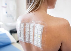Everything You Need to Know About Allergy Patch Testing